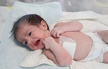 Yemek Borusu Olmadan Doğdu!