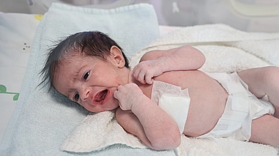 Yemek Borusu Olmadan Doğdu!