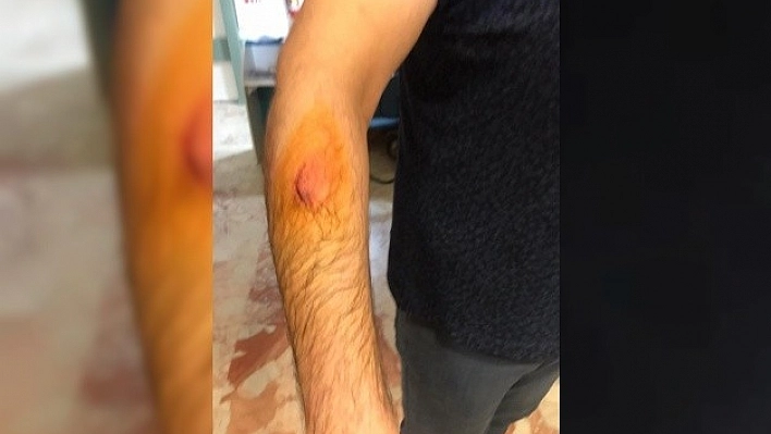 Elazığ'da Sağlık Çalışanı Darp Edildi