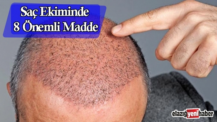 Saç Ektirmek İsteyenler Dikkat !