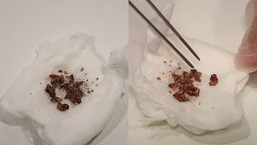 Elazığ'da Hayretlere Düşüren Olay!