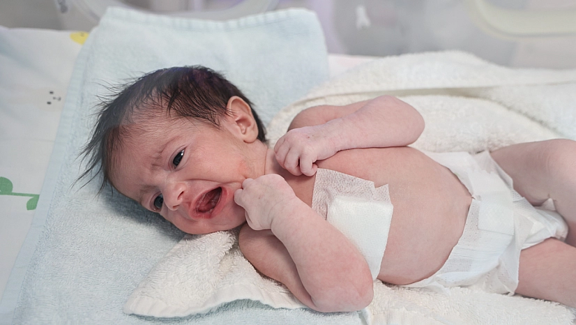 Yemek Borusu Olmadan Doğdu!