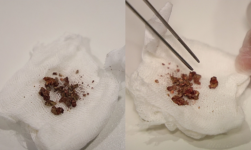 Elazığ'da Hayretlere Düşüren Olay!