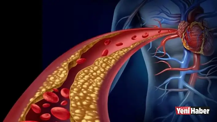 Yeni Umut Kolesterol Aşısı!