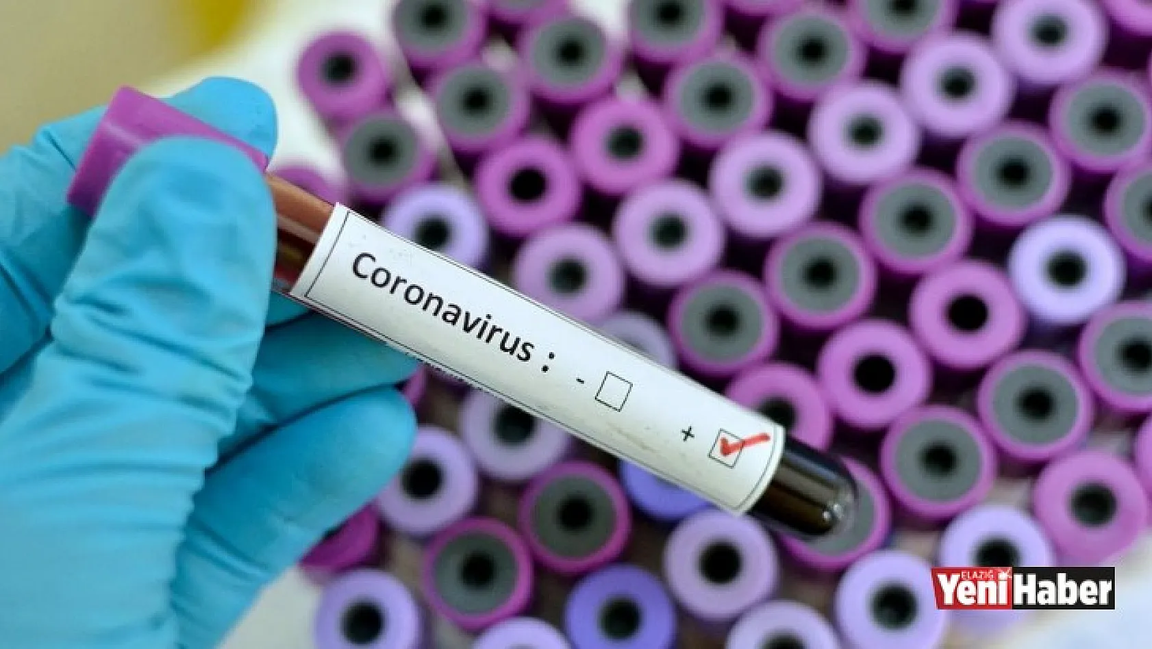 17 Şubat 2021 Koronavirüs Tablosu!