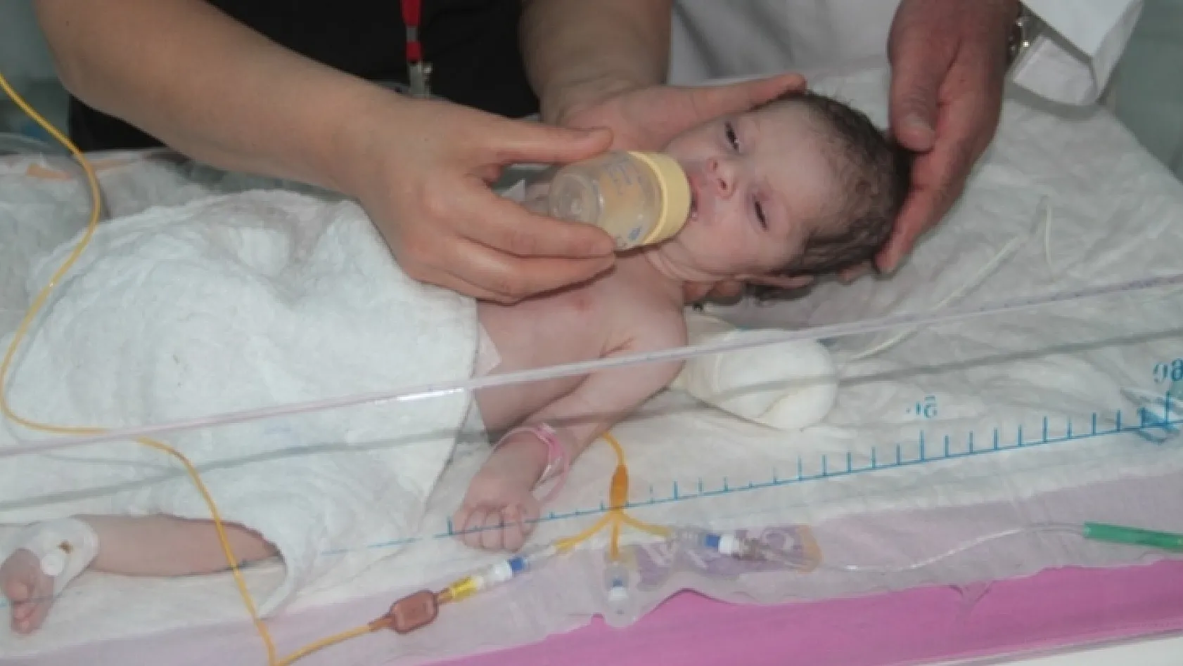 Minik Bebek Başarılı Operasyonla Hayata Tutundu